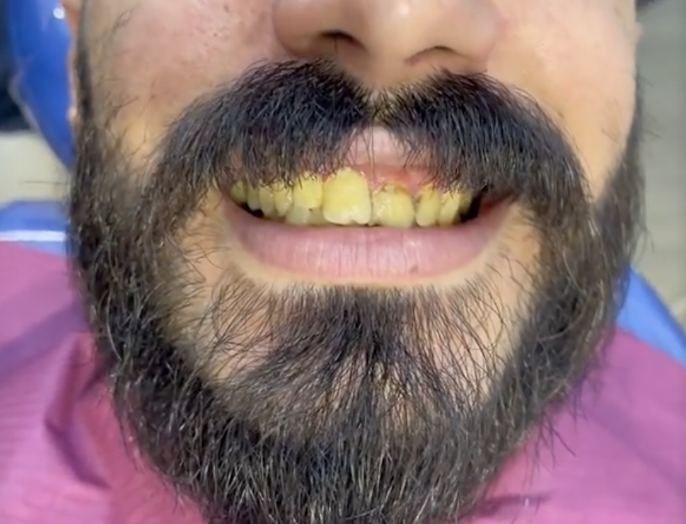 قبل